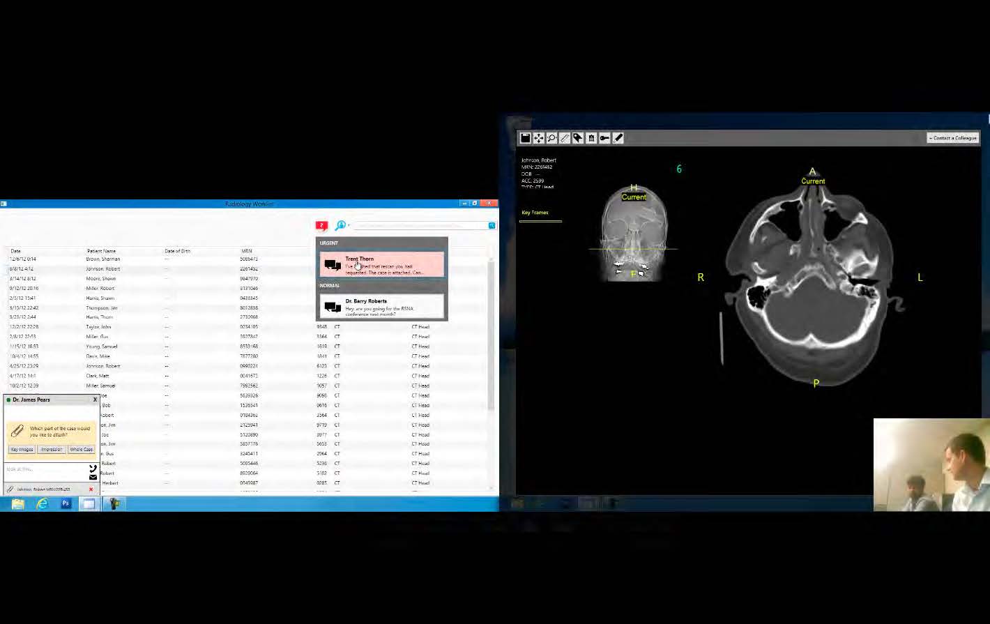 A screenshot of a live software prototype evaluation with a radiologist depicted in the bottom right-hand corner of the window